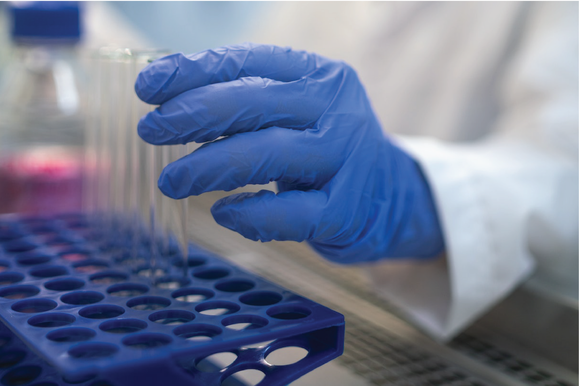 How to properly dispose medical gloves?